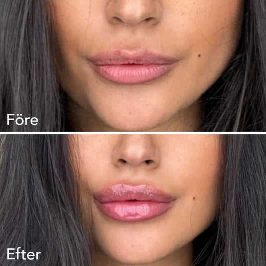 Extreme Lip Plumper
