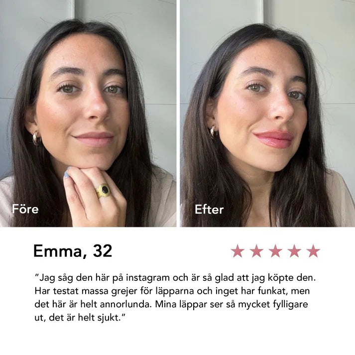 Extreme Lip Plumper
