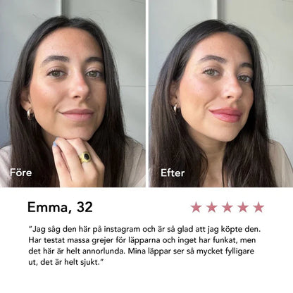 Extreme Lip Plumper
