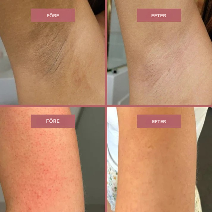 Body Peel Spray