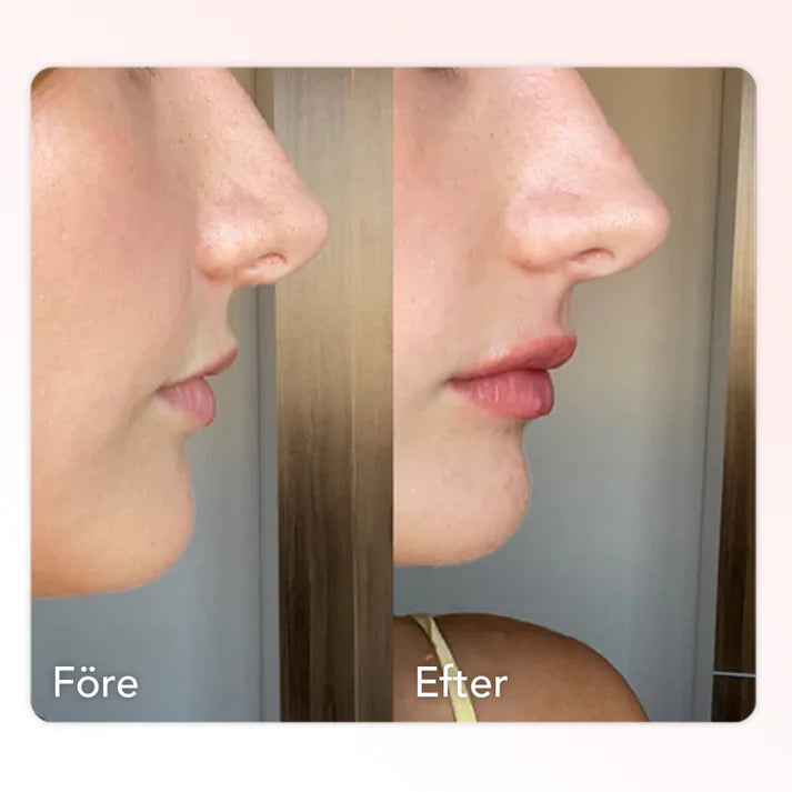 Extreme Lip Plumper
