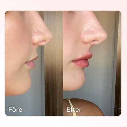 Extreme Lip Plumper